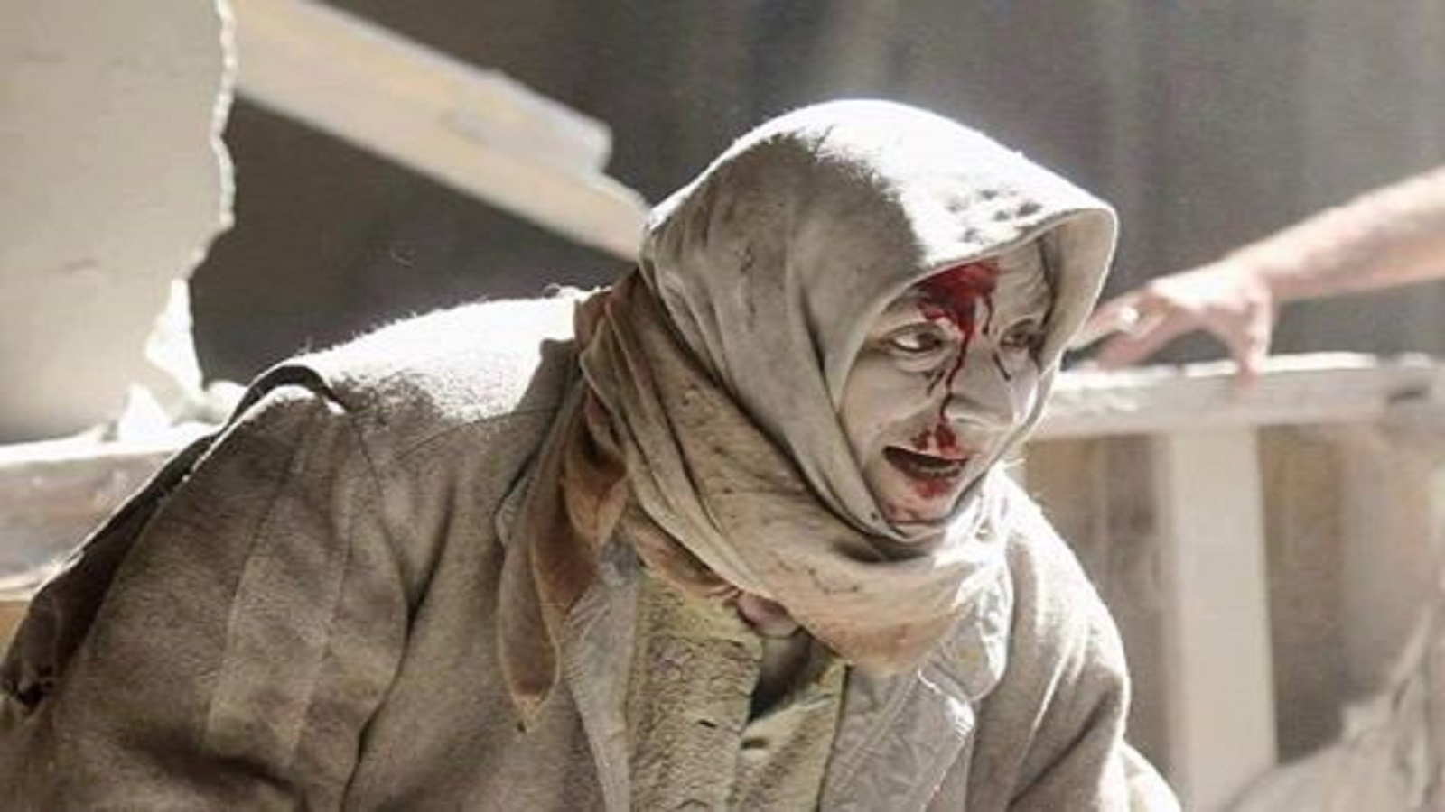 استبدلوا الأحمر بالصور الحية.. حلب تُباد