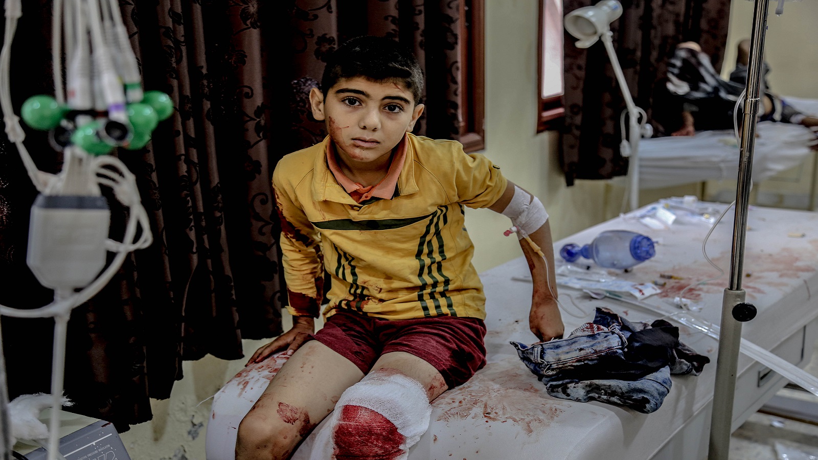 روتين المجازر في سوريا.. ألم التكرار بعد ألم المأساة